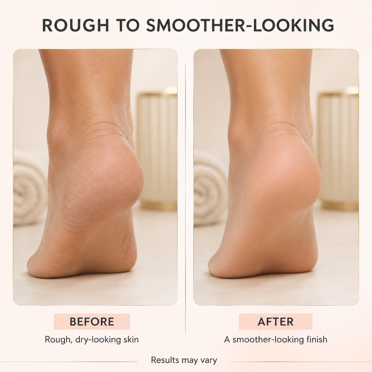 Electric Pedicure Foot File Callus Remover